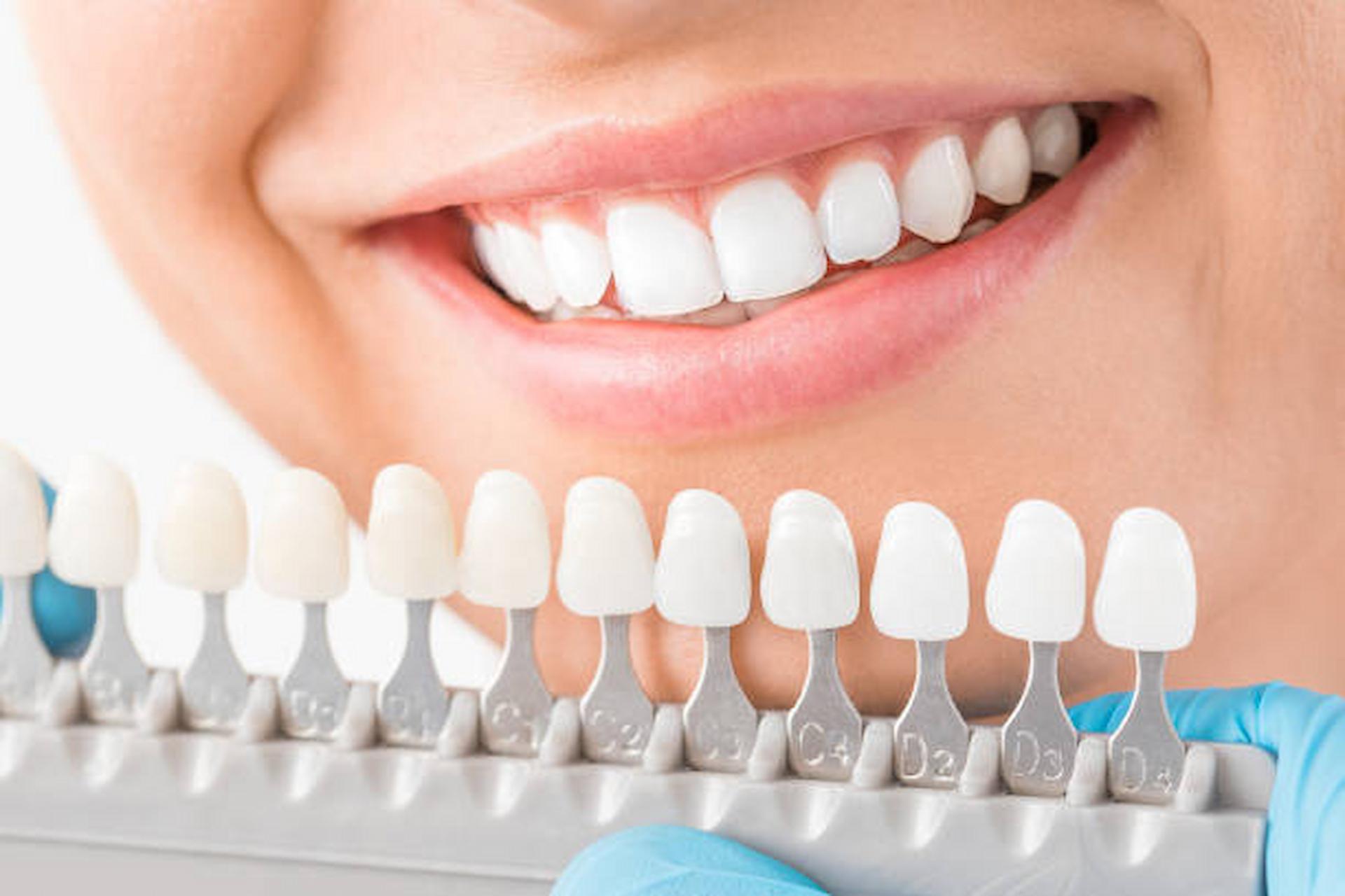 Why Are Cosmetic Dental Treatments So Popular?